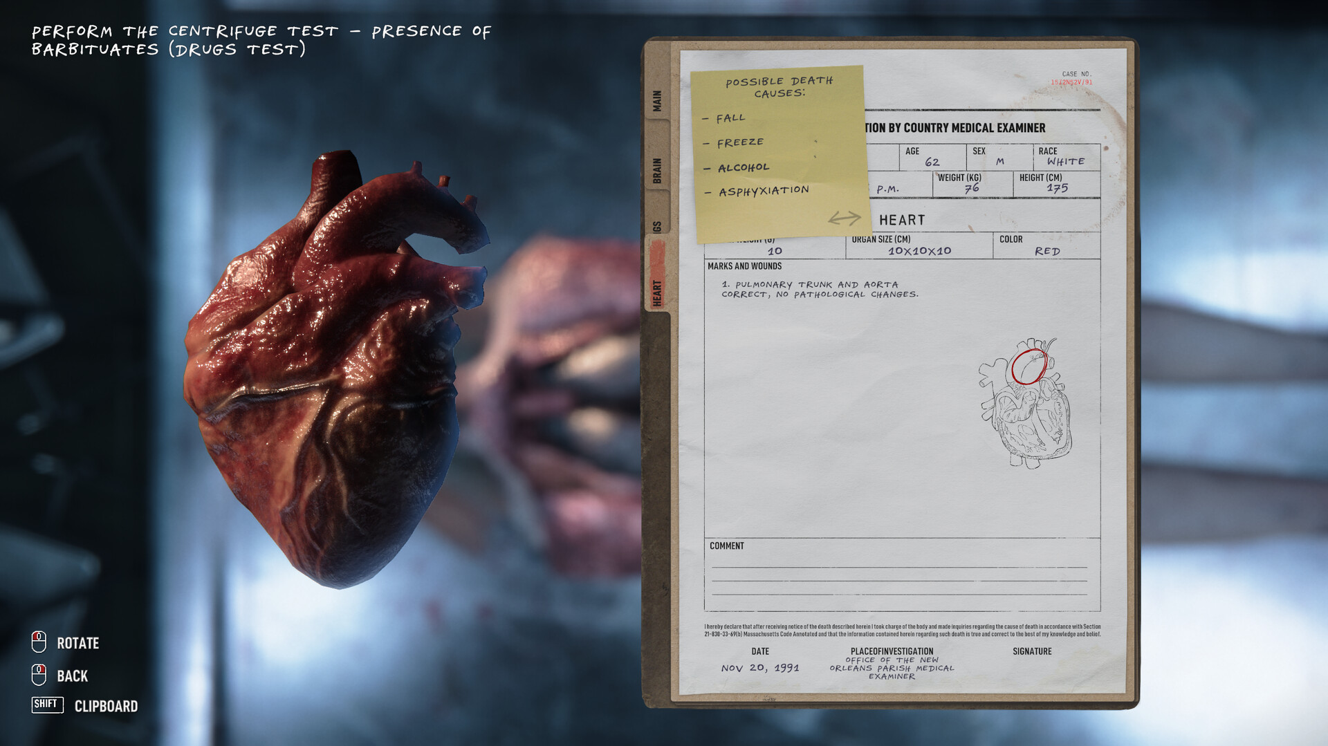《验尸模拟器(Autopsy Simulator)》|v153.413|中文|免安装硬盘版 《验尸模拟器(Autopsy Simulator)》|v153.413|中文|免安装硬盘版