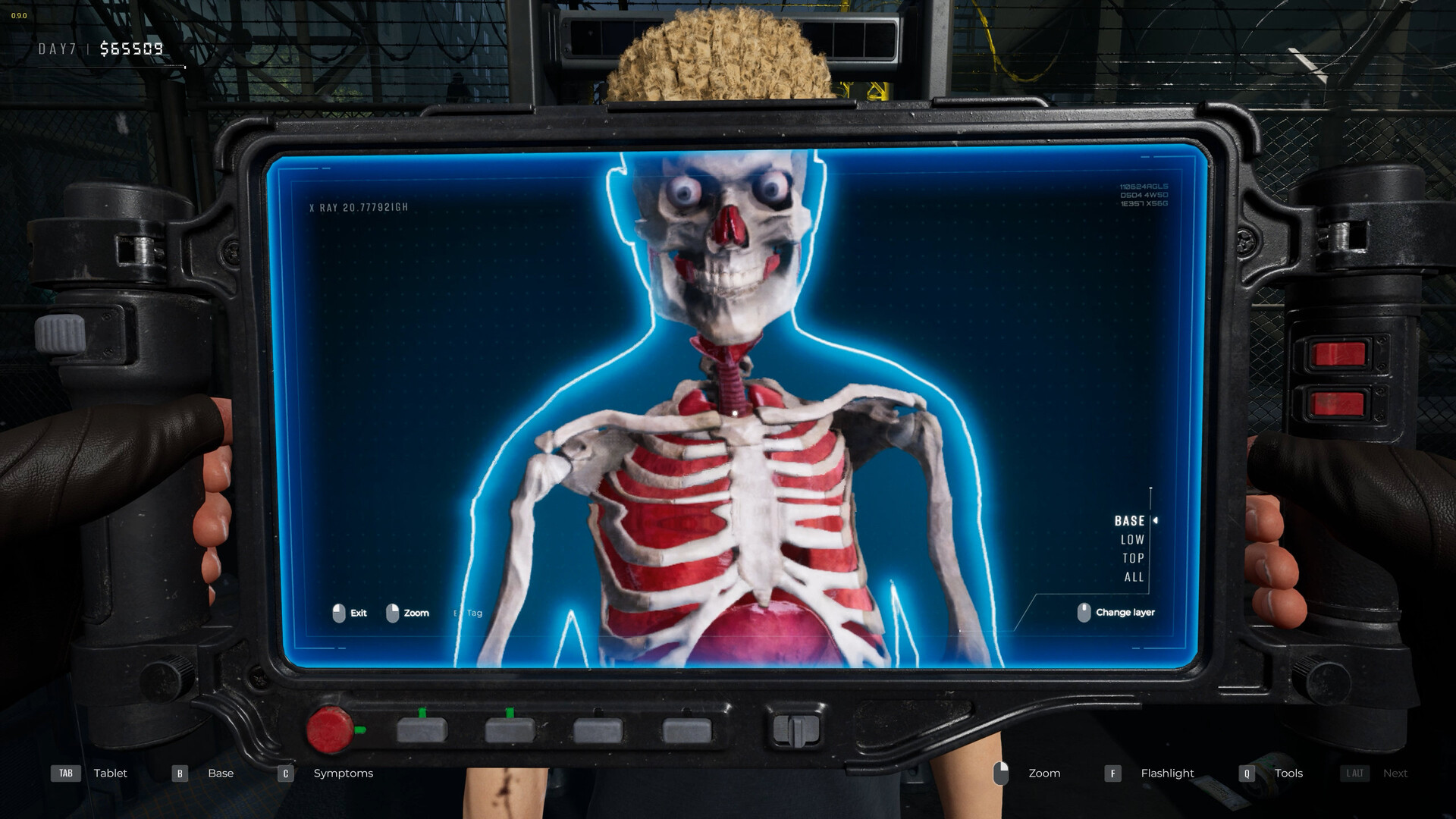 检疫区：最后一站 (Quarantine Zone: The Last Check)